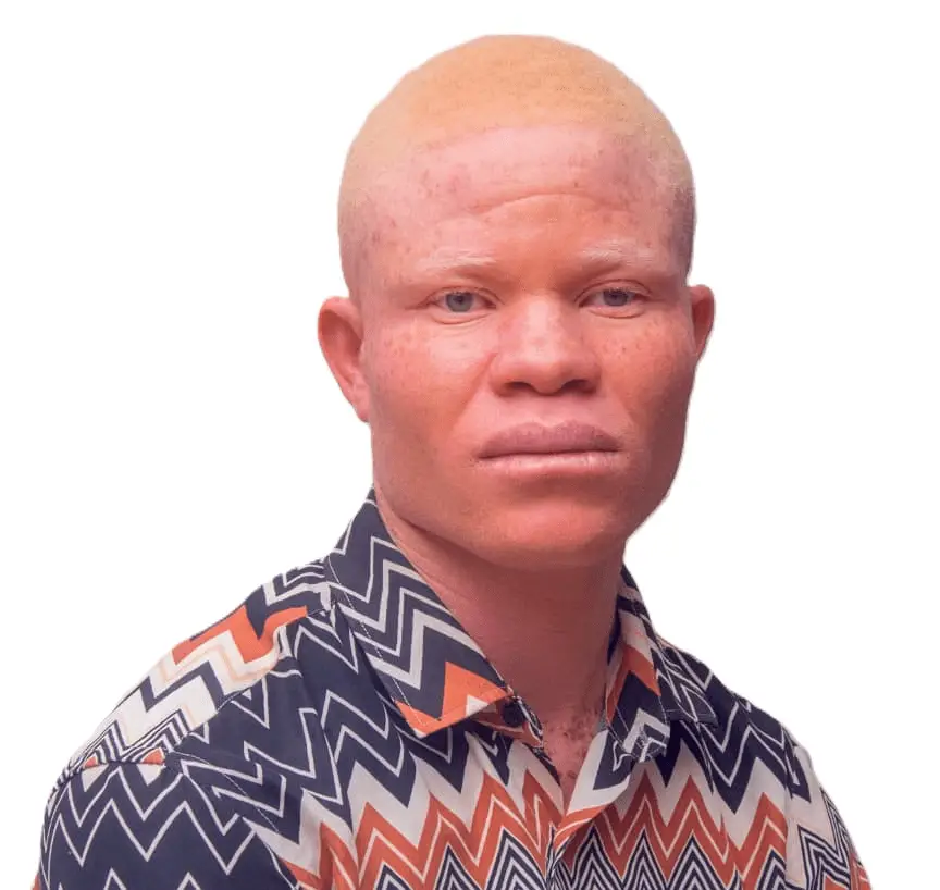 Daniel Otera Program & Communications Assistant A young man with Albinism